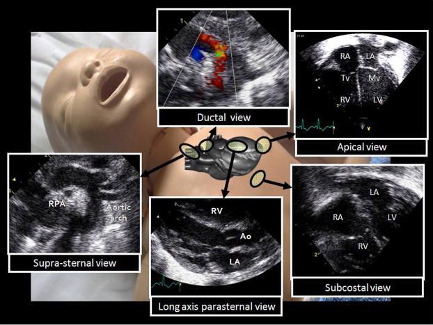 Neonatal Medicine,