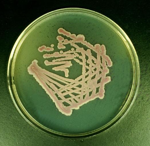 štěpit specifický substrát změní chromogen