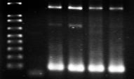 Výsledky K amplifikaci genu pro β 2 -microglobulin (Obr. 13) byl použit 1 µl cdna a 24 µl PCR mixu. Amplifikace probíhala po dobu 28 cyklů při teplotě annealing 60 C.