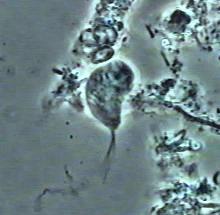 2.4 Nejčastější symbionti člověka 2.4.1 Komenzální prvoci Bičenka zubní(trichomonas tenax) Říše: Excavata; Kmen: Parabasala; Třída: Trichomonadea; Řád: Trichomonadida; příklady příbuzných zástupců: