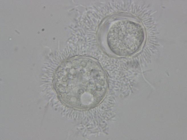 2.4.2 Parazitičtí prvoci Akantaméba Castellaniho (Acanthamoeba castellani) Říše: Amoebozoa; Kmen: Rhizopoda; Třída: Lobosea; Řád: Acanthopodida; příklady příbuzných zástupců: Acanthomoeba polyphaga,