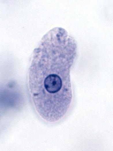 12: Mikrofoto Entamoeba histolytica Převzato z: http://www.kstate.edu/parasitology/625tutorials/fighistolytica05.
