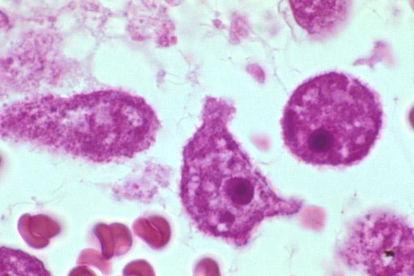 jpg Naeglerie zhoubná (Naegleria fowleri) Říše: Excavata; Kmen: Heterolobosea; Třída: Heterolobosea; Řád: Schizopyrenida; příklady příbuzných zástupců: Naegleria italica Naeglerie zhoubná (viz Obr.