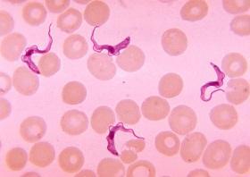 morfologická stadia (amastigot, promastigot, epimastigot, trypomastigot). Ta se liší délkou bičíku, polohou kinetoplastidu, přítomností undulující membrány a jiných typických znaků.
