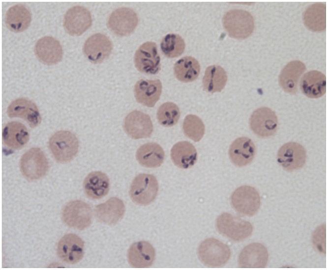 Obr. 23: Mikrofoto Babesia divergens Převzato z: http://previews.figshare.com/1116665/preview_1116665.