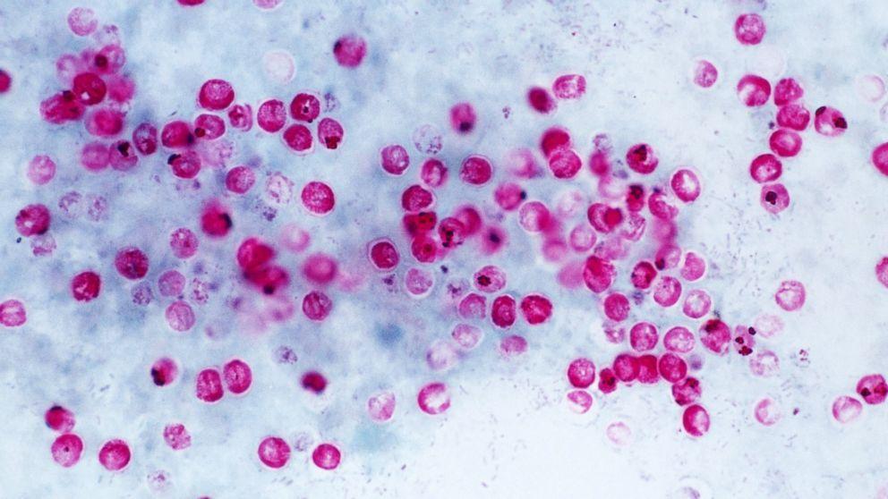 Kryptosporidie malá(cryptosporidium parvum) Říše: Sar; Kmen: Apicomplexa; Třída: Cryptosporidea; příklady příbuzných zástupců: Cryptosporidium hominis Kryptosporidie (viz Obr.