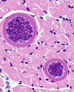Svalovka prasečí (Sarcocystis suihominis) Říše: Sar; Kmen: Apicomplexa; Třída: Coccidea; Řád: Eimeriida; příklady příbuzných zástupců: Sarcocystis hominis Příbuzný druh svalovky tuří je svalovka