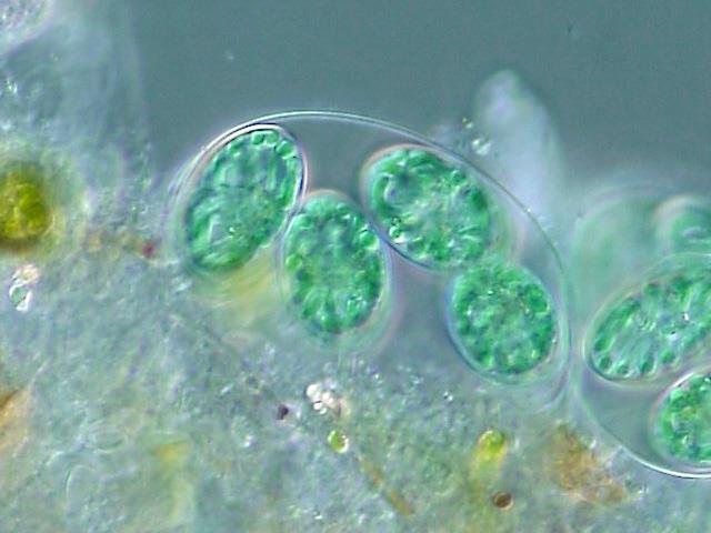 Glaucophyta Primitivní chloroplast s peptidoglykanovou vrstvou je