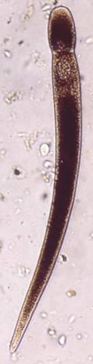 Třída: Gregarina (hromadinky) parazitují v TS x dutině bezobratlých vetšinou MONOXENNÍ paraziti trofozoit = obrovsky zvětšený sporozoit - dospělí trofozoiti = nejnápadnější stádium - a) zanořen
