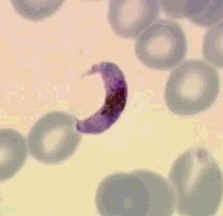 původce tropické malárie Plasmodium falciparum periodicita: nepravidelné záchvaty (1-3 dny) maligní terciána falx= srp v