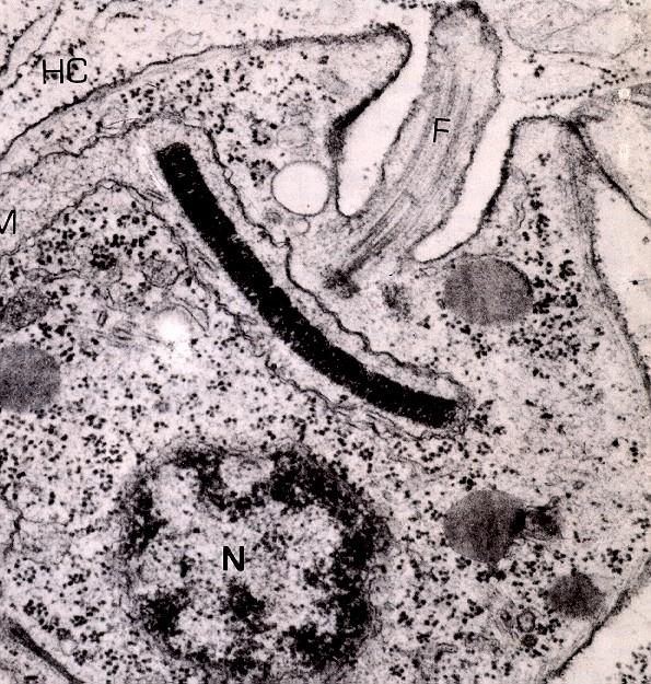 Eukinetoplast síť u báze kinetozómu - Trypanosoma, Crithidia,