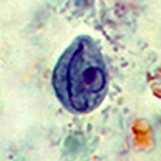 bezobratlých a obratlovců Chilomastix mesnili parazit tlustého