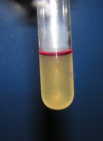Biochemické testy na potvrzení / vyvrácení přítomnosti koliformních bakterií Oxidázový test umělohmotné proužky s detekčním papírkem nebo disky z filtračního papíru, se přiloží přímo na kolonii,