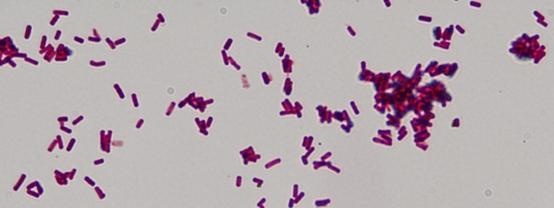 Micrococcus luteus G+ Escherichia coli G- 4.