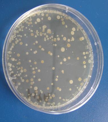 Bacillus přítomen Bacillus nepřítomen Doplňující úkol: Naočkováním na pevnou půdu potvrdit kultivací přítomnost mikroorganismů v
