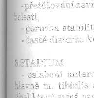 tlexor hallucis brevis, - subluxace metatarzophalangeálních kloubů, ktera vede k patologickému postavení prst ů na DK - kladívkové prsty, - pokles příčné klenby nohy, rozvoj pes excava tus, -