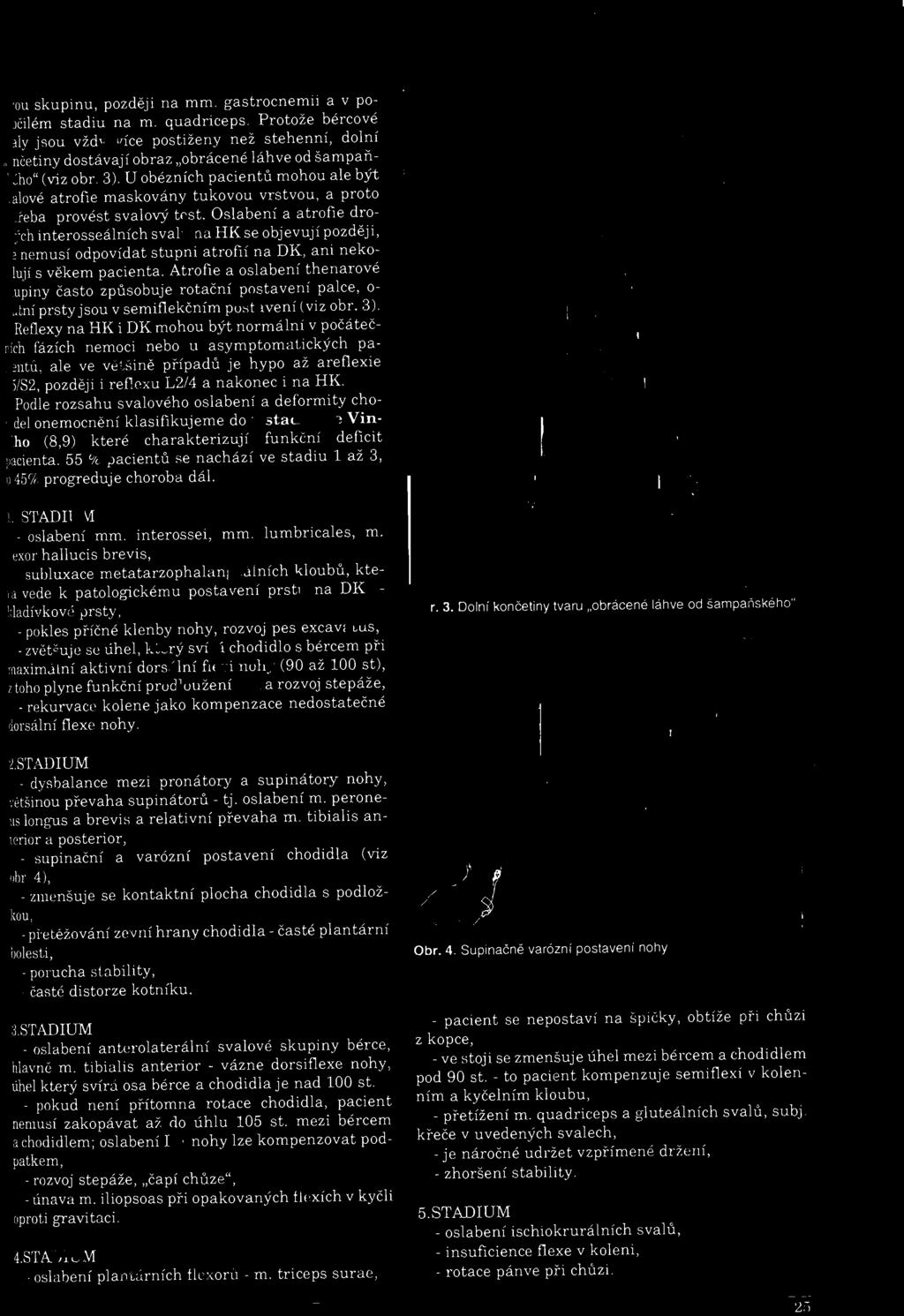 imální aktivní dorsální fl xi nohy (90 až 100 st), I toho plyne funkční prodloužení DK a rozvoj stepáže, rekurvace kolene jako kompenzace nedostatečné dorsální flexe nohy. 2.