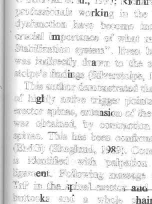 ./))/ I afuroilll UVINGSlONE MarÍual Therapy 9 (2004) 173-175 Case report A case of selective. paresis of the deep stabilization system due to boreliosis K. L~wit *,o.