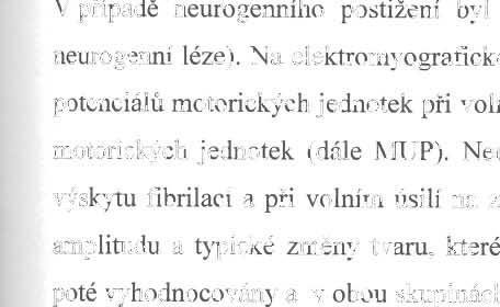 Pro účely studie je vyšetření dostatečn ě přesné a lze si udělat základní představu o rozsahu a intenzi tě neurogenního postižení ve více oblastech páteře a to i ve vztahu k deviacím o.p., což bylo jedním z c ílů této studie.