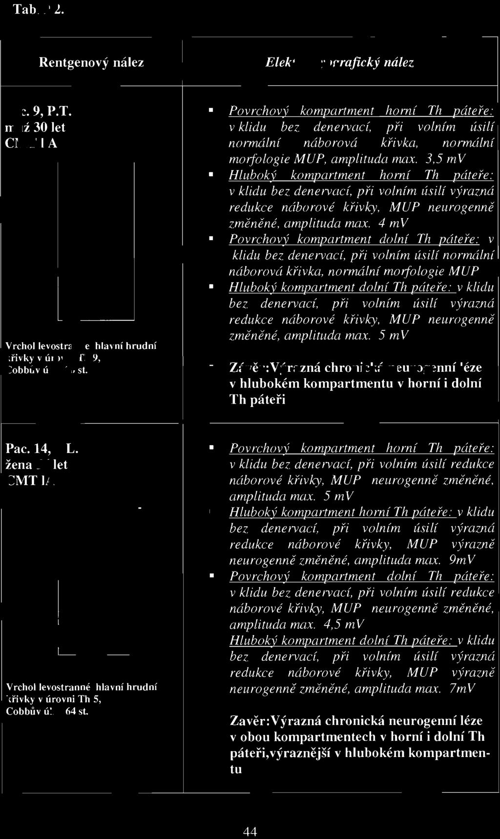 3,5 mv Hluboký kompartment horní Th páteře: v klidu bez denervací, při volním úsif{ výrazná redukce náborové křivky, MUP neurogenně změněné, amplituda nulx.