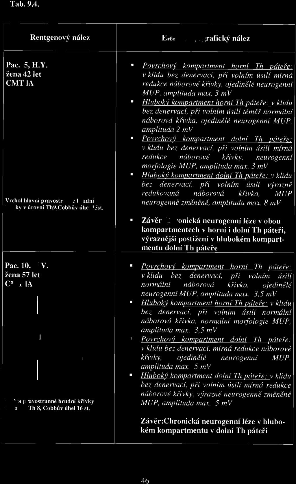 3 mv Hluboký kompartment dolní Th páteře: v klidu bez denervací, při volním úsilí vý razn.ě redukovaná náborová křivka, MUP neurogenně z měněné, amplituda max.