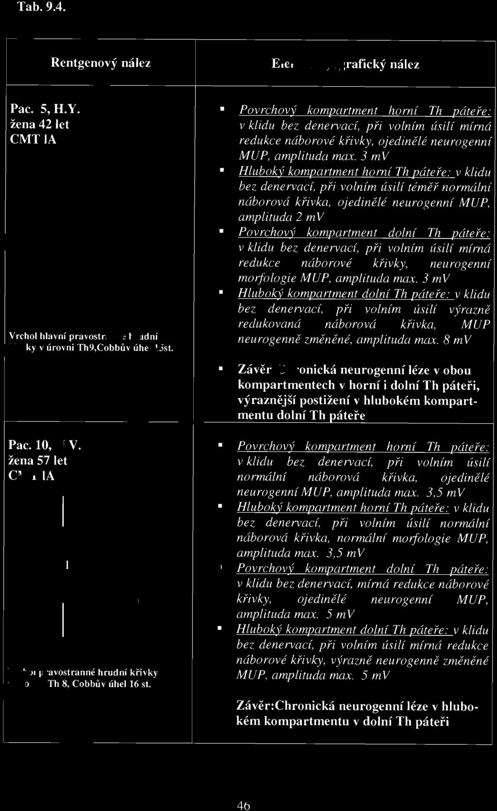 3 mv Hluboký kompartment dolní Th páteře: v klidu bez denervací, při volním úsilí vý razn.ě redukovaná náborová křivka, MUP neurogenně z měněné, amplituda max.