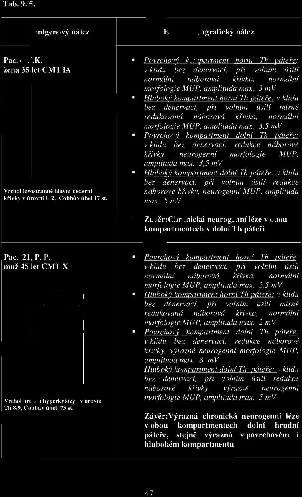 3,5 mv Povrchový kompartment dolní Th páteře : v klidu bez denervad, redukce náborové křivky, neurogenní morfologie MUP, Hluboký kompartment dolní Th páteře: v klidu bez denervací, při volním úsilí