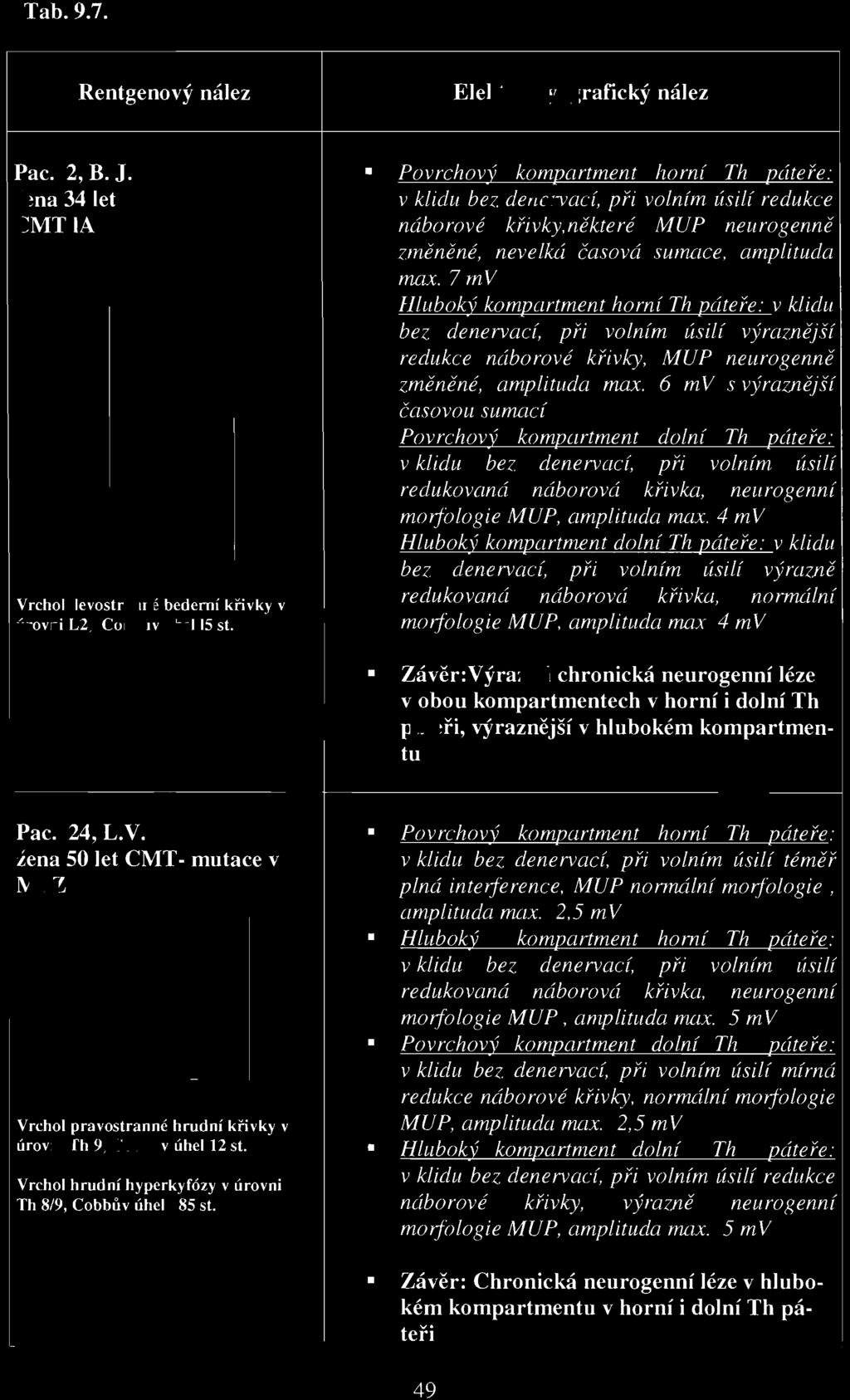 4 mv Hluboký kompartment dolní Th páteře: v klidu bez denervací, při volním úsilí výrazně redukovaná náborová křivka, normální molj'ologie MUP, amplituda max.