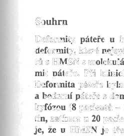 z KLINICKt PRAXE Ces. a slov. Neurol. Neurochir., 68/101, 2005, No. 2, p. 109-115. Deformity p á teře u hereditární motoricko-senzitivní neuropatie Horáček, 0.1, Mazanec R.2, Kobesová, A.I, Seeman, P.