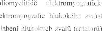 Vět š inou se neuromuskulámí deviace O.p. rozvíjejí v časnějším v ěku než idiopatická skolióza a ně kdy mohou být dokonce i prvním p řízn akem neuromuskulámího onemocnění (10).