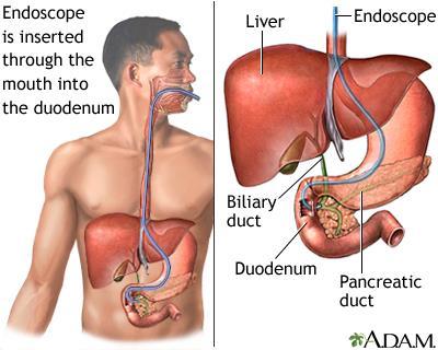 Gastroskopie Endoskopické možnosti Endoskopická retrográdní