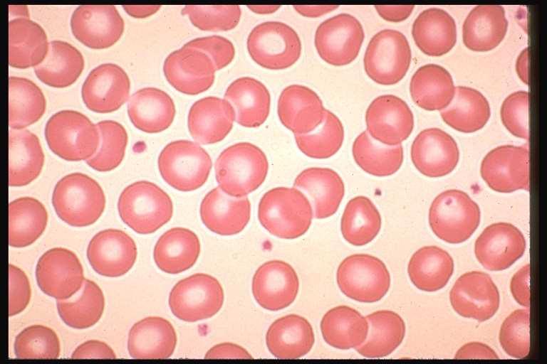ERYTROCYTY (červené krvinky) Obrázek převzat z http://www.vghtpe.gov.