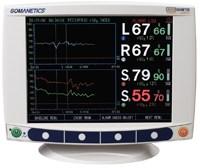 Kontinuální monitorování cerebrální oxygenace (rcspo 2 ) Near infrared