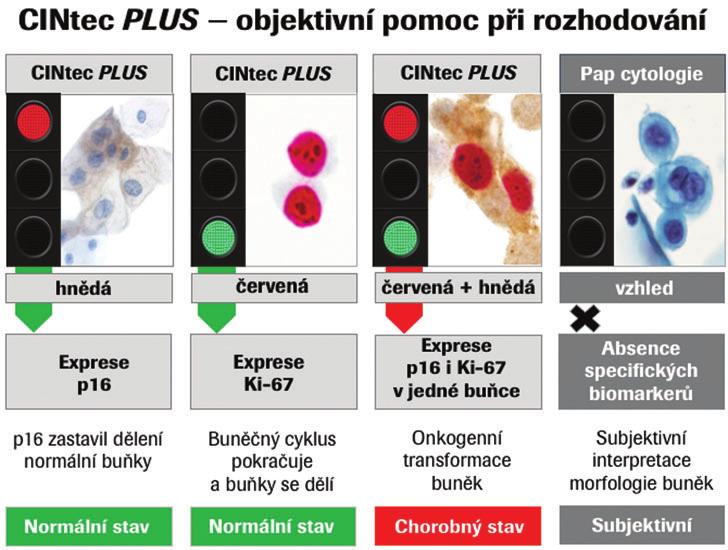 s genotypizací HPV, doplnìný kolposkopií u HR HPV 16/18, resp.