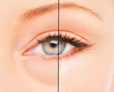 md:complex GenX Eye Contour SLOŽENÍ SLOŽENÍ md:complex GENX Eye Contour Komplexní omlazení očního okolí VÝTAŽEK Z LISTŮ CYNARA SCOLYMUS (ARTYČOK) Obnovuje mikrocirkulaci, zlepšuje dodávku živin a