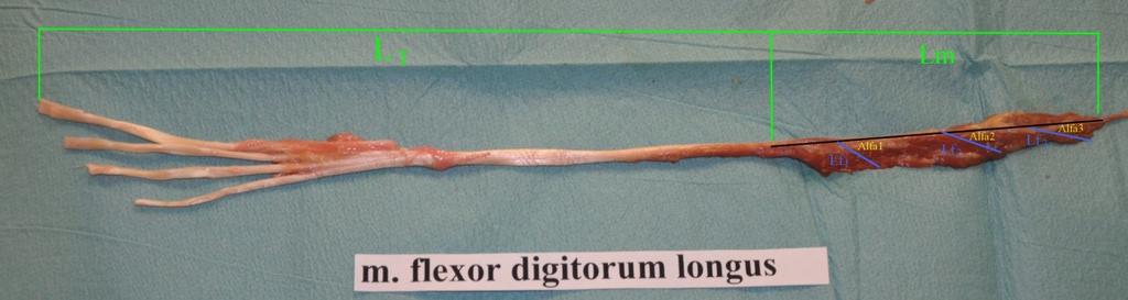 flexor hallucis longus, L T - délka mimosvalové části šlachy, Lm- délka svalu, Lf 1 -Lf 3 - délka svalových vláken, Alfa 1 Alfa 3- pennation úhel 1.