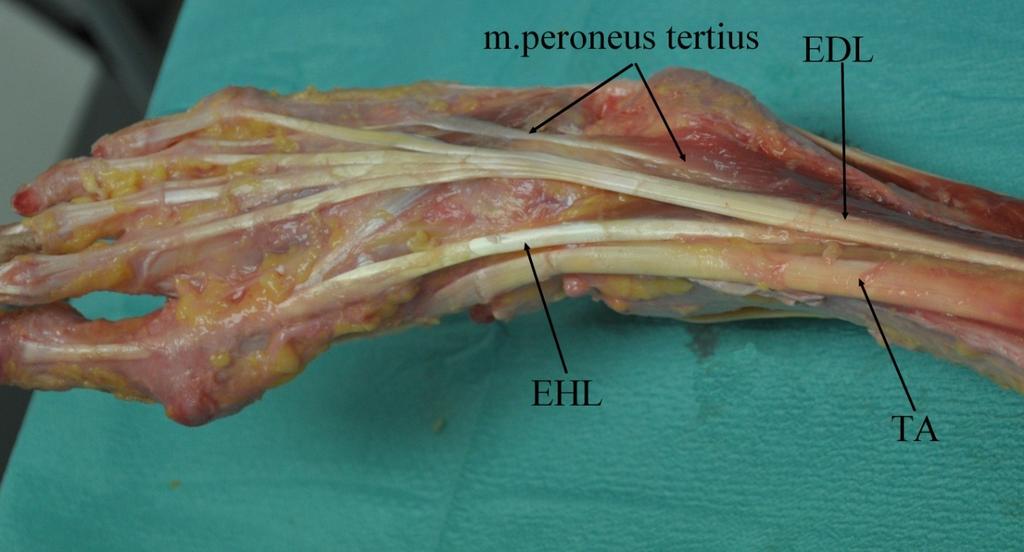 tibialis anterior (TA), uprostřed dlouhý extenzor palce (EHL) a nejlaterálněji dlouhý extenzor prstů