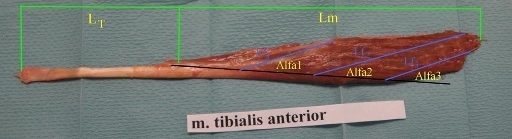 Obrázek 3: Preparát m. tibialis anterior, L T - délka mimosvalové části šlachy, Lm- délka svalu, Lf 1 -Lf 3 - délka svalových vláken, Alfa 1 Alfa 3- pennation úhel Obrázek 4: Preparát m.