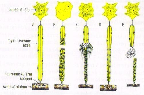 1 2 mm za den v distálním úseku nervu, v proximální části nervu je to až 6 8 mm za den. Průměr se udává asi 1 2 mm za den.