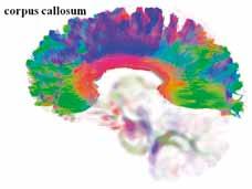 CST corticospinal tract Obr. 4C Obr. 4D Obr. 5A
