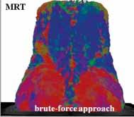 The Figure shows a diffusion tensor map (A) with brute-force approach (B) and multi-roi approach (c-d), in MR tractography of the kidney (C) and psoas major muscle (D).