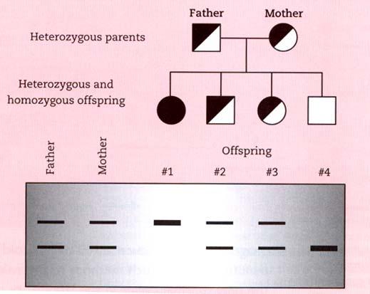Southernova analýza potomků heterozygotních rodičů (RFLP) Pokud je výskyt většího