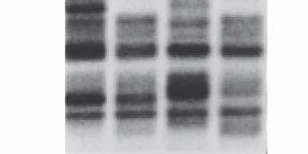 zobrazení profilu DNA