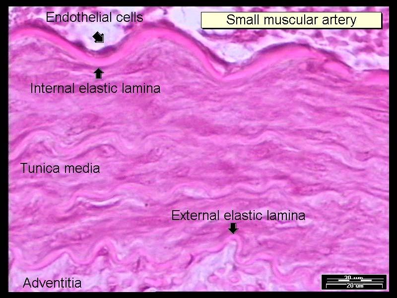 Svalová arterie TI: endotel + subendotel (s
