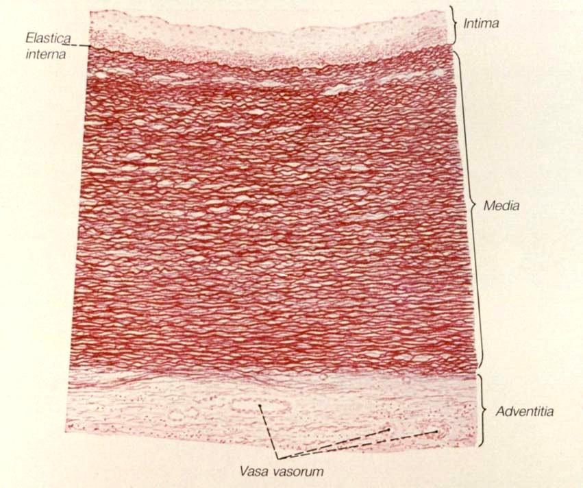 Elastické arterie TI: endotel + subendotel (100 m široká