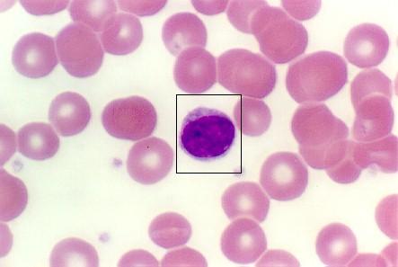 Lymfocyty 20-25 % z DBOK cytoplazma modrá s azurofilními granuly, četné ribosomy jádro kulaté,