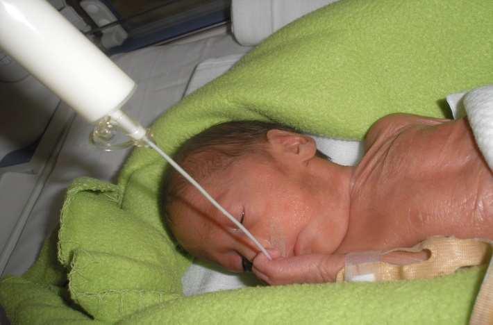 Apnoe prejavy a výskyt BRADYKARDIA - v 10% trvá 10 14 s BRADYKARDIA - v 34% trvá