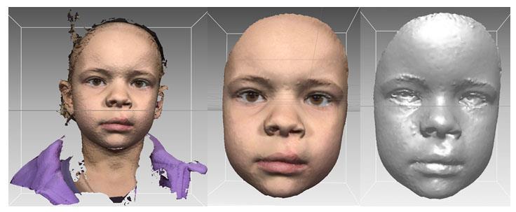 5 Metodologie 5.1 Sběr a úprava virtuálních dat Pro účel analýz byly pořízeny 3D faciální modely každého jedince.