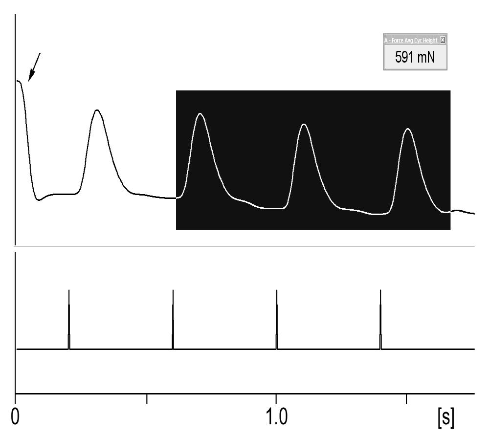 Jméno: Skupina: Datum:. V miniokně Panelu stimulátoru (Stimulator panel) jsou nastaveny následující parametry: frekvence Hz, trvání podnětu (pulse duration) μs, amplituda (amplitude) ma.