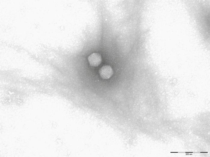 virové střevní infekce virové gastroenteritidy Obr. 1. Adenovirus. Foto: Krsek D. závratěmi a točením hlavy.
